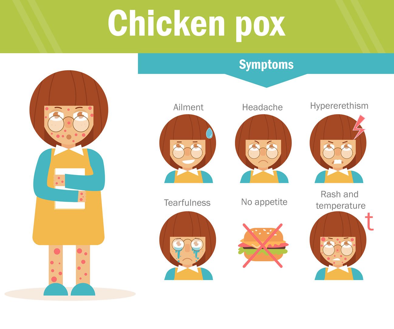 chicken-pox-symptoms